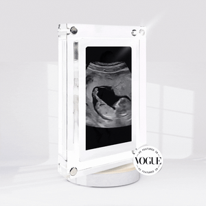 CradleStory Live Ultrasound Frame™